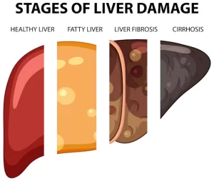 Signs Your Liver is Healing from Alcohol