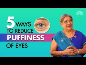 Home Remedies for Puffy Eyes I Treat puffy eyes naturally I Dr. Hansaji