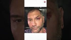 Dave Bautista has had some pretty gnarly injuries  #menshealth