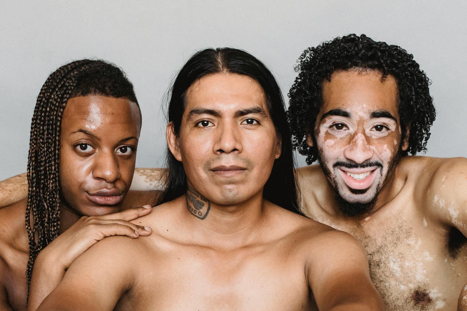 Positive homosexual male with naked torso and vitiligo skin hugging black and American Indian friends while looking at camera together